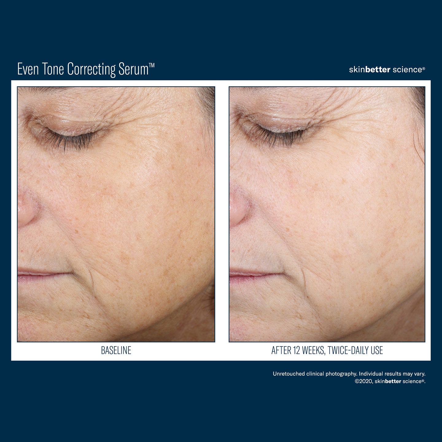SBS Even Tone Correcting Serum