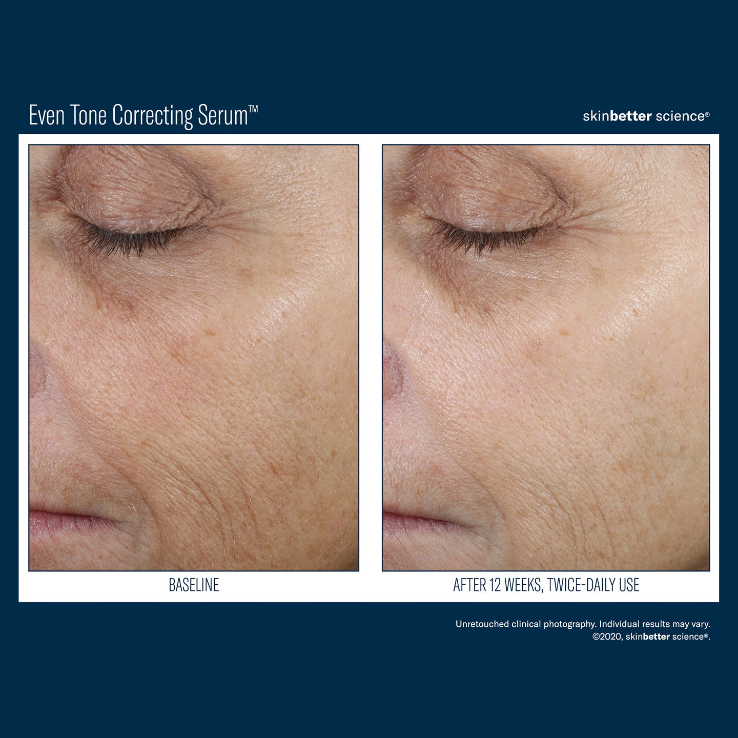 SBS Even Tone Correcting Serum