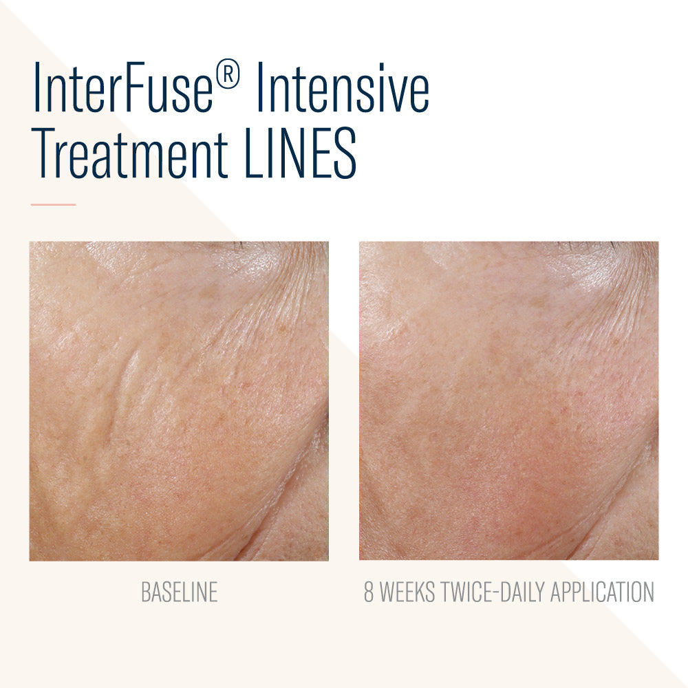 SBS Interfuse Treatment Cream LINES